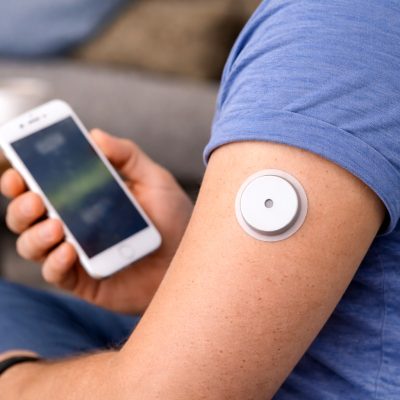 Встановлення та супровід системи безперервного моніторингу глюкози (CGM)